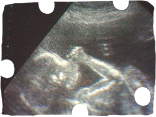 Hebamme Josefin
